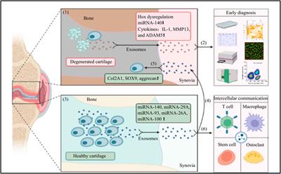 The application of exosomes in the early diagnosis and treatment of osteoarthritis